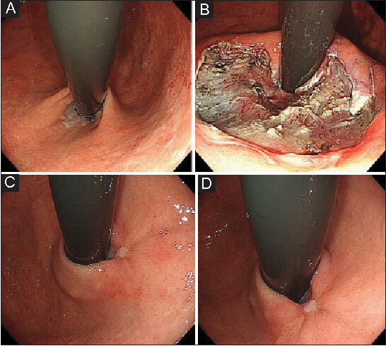 Modern colonoscopy medical room with advanced equipment